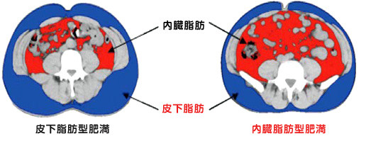 内臓脂肪と皮下脂肪